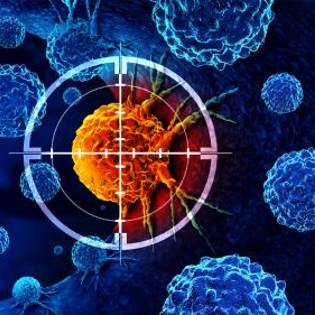 Precision Oncology